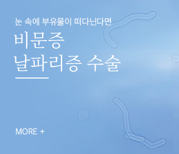 비문증 날파리증 수술